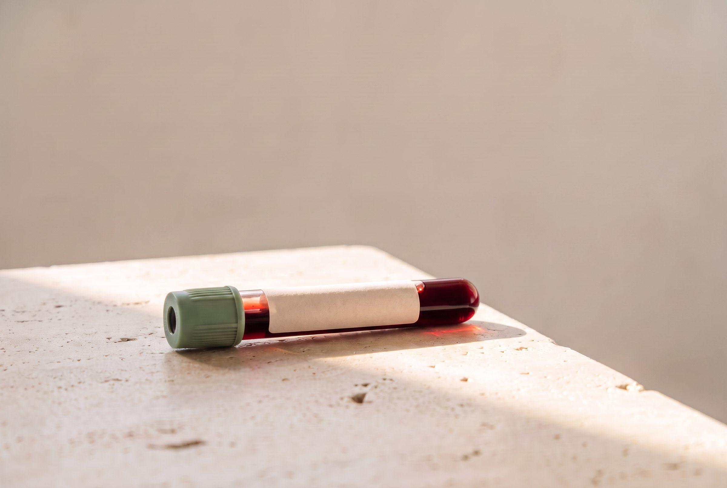 Un tubo de sangre con tapón verde salvia bajo un rayo de luz de la mañana