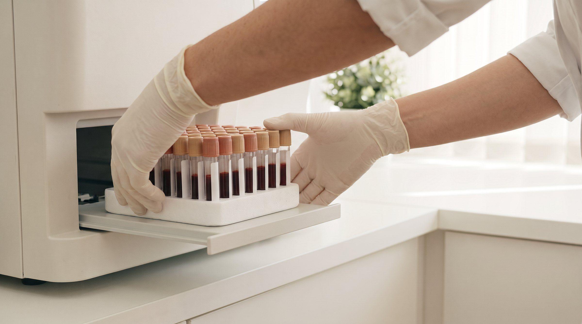 Rows of colour-capped blood tubes in a laboratory rack